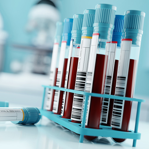 Doctor performing surgery with a team